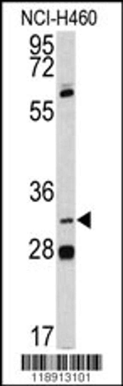 Western blot analysis of PITX1 antibody in NCI-H460 cell line lysates (35ug/lane)