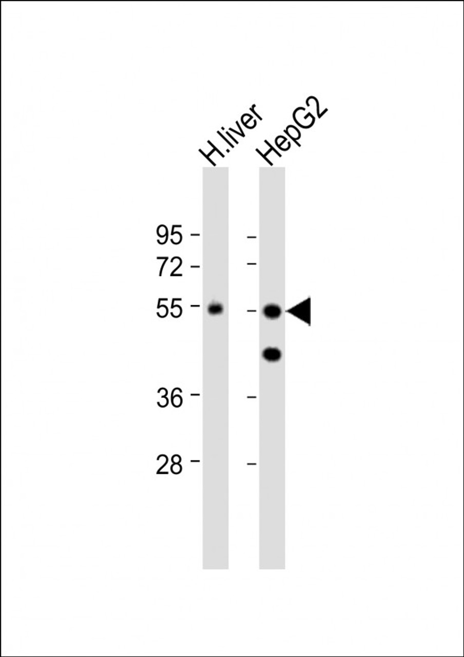 Western Blot at 1:1000 dilution Lane 1: human liver lysate Lane 2: HepG2 whole cell lysate Lysates/proteins at 20 ug per lane.