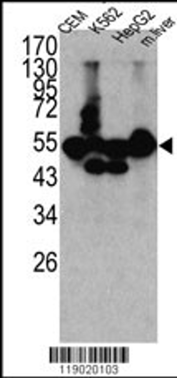 Western blot analysis of CPN1 antibody in K562, CEM, HEpG2 cell line lysates and mouse liver tissue lysates (35ug/lane)