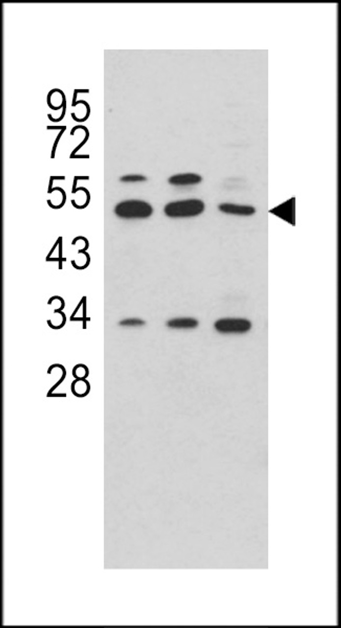 Western blot analysis of CPA4 antibody in Hela, CEM and NCI-H460 cell line lysates (35ug/lane)