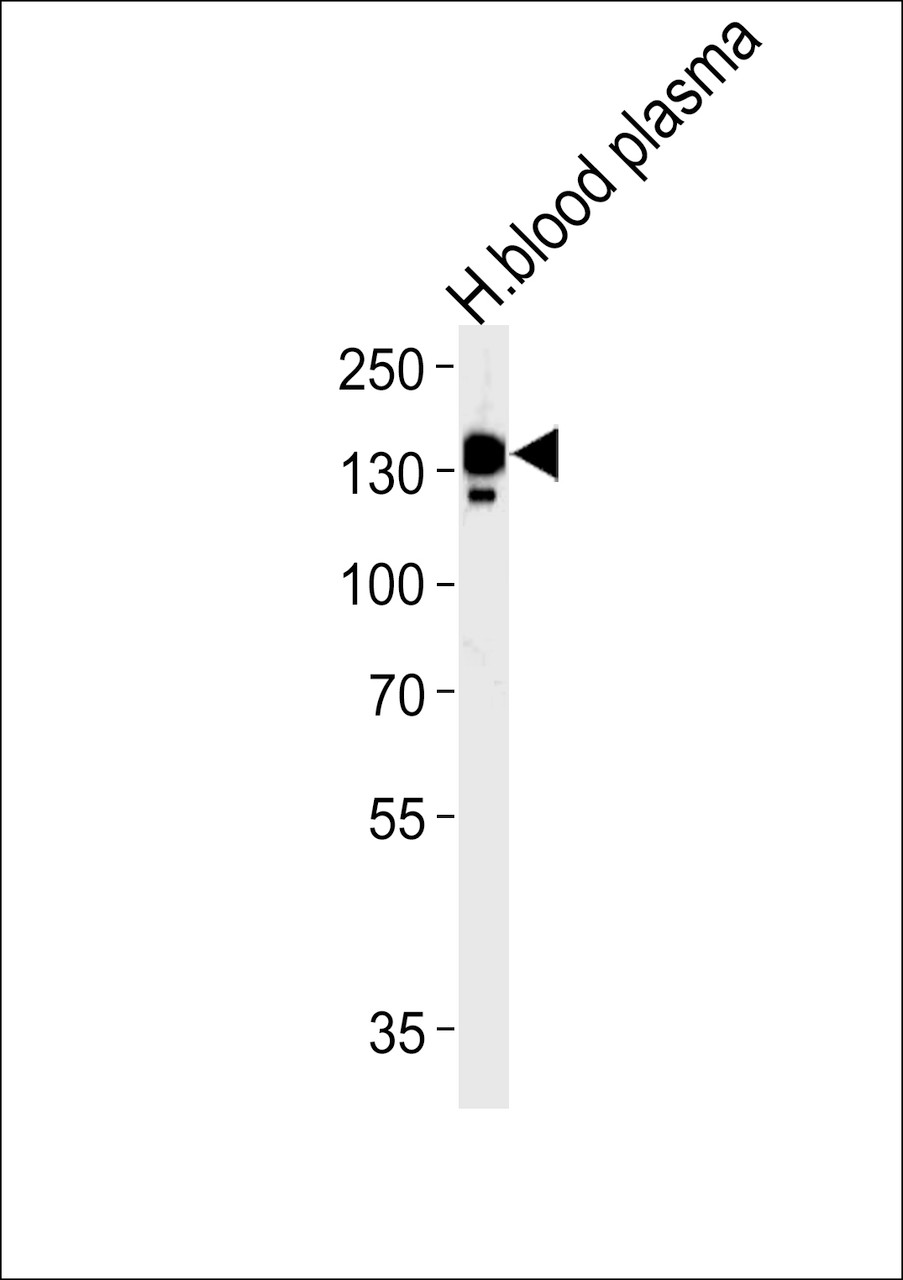 Western blot analysis in human blood plasma tissue lysates (35ug/lane) .This demonstrates the CP antibody detected the CP protein (arrow) .