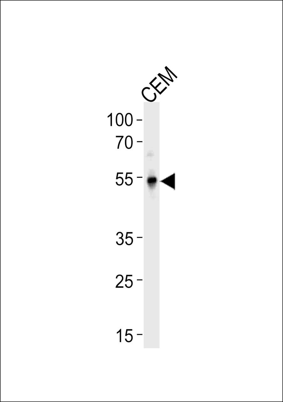 Western blot analysis in CEM cell line lysates (35ug/lane) .