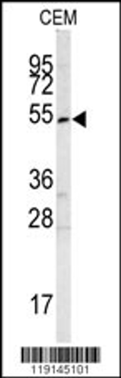 Western blot analysis of SMYD3 antibody in CEM cell line lysates (35ug/lane)