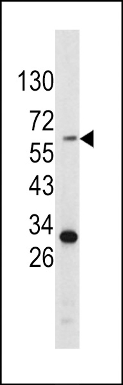 Western blot analysis of Tyrosinase antibody in HepG2 cell line lysates (35ug/lane)