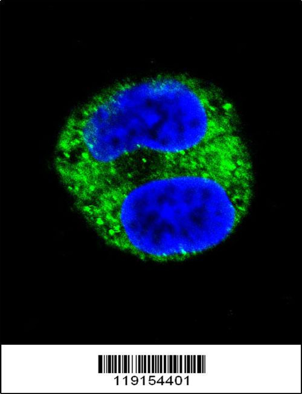 Confocal immunofluorescent analysis of TYR Antibody with HepG2 cell followed by Alexa Fluor 488-conjugated goat anti-rabbit lgG (green) .DAPI was used to stain the cell nuclear (blue) .