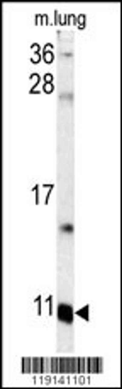Western blot analysis of S100A6 antibody in mouse lung tissue lysates (35ug/lane)