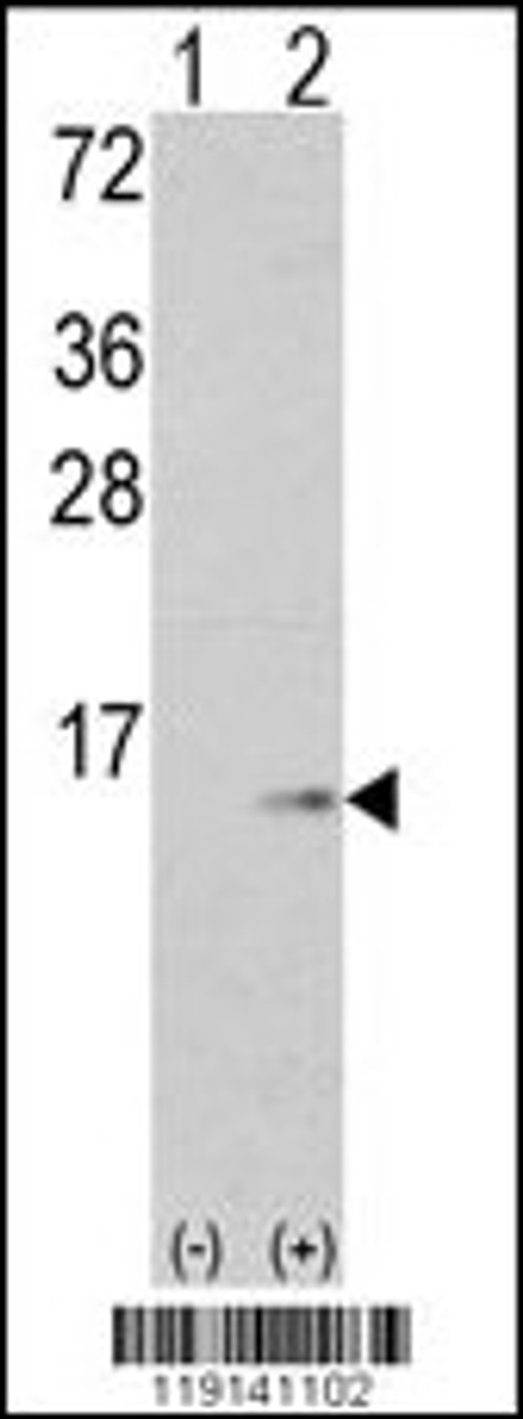 Western blot analysis of S100A6 using rabbit polyclonal S100A6 Antibody.293 cell lysates (2 ug/lane) either nontransfected (Lane 1) or transiently transfected with the S100A6 gene (Lane 2) .
