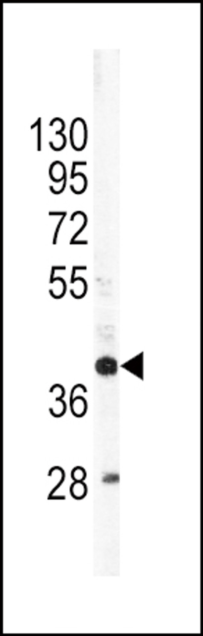 Western blot analysis of APOL1 Antibody in SK-Br-3 cell line lysates (35ug/lane)