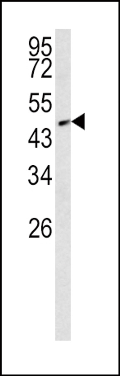 Western blot analysis of SMAD2 Antibody (T220) in NCI-H460 cell line lysates (35ug/lane)