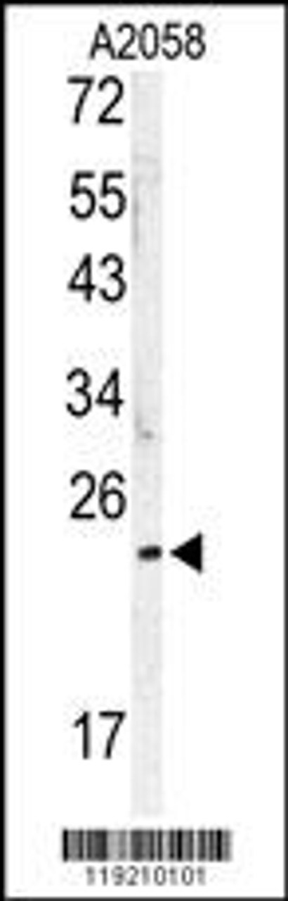 Western blot analysis of MOBKL1B antibody in A2058 cell line lysates (35ug/lane)