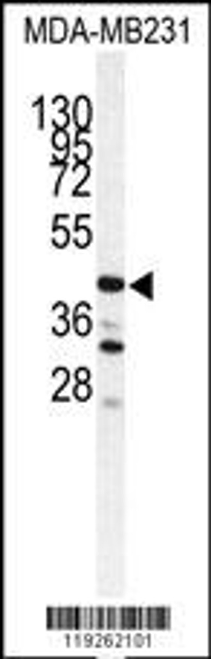 Western blot analysis of CTSS antibody in MDA-MB231 cell line lysates (35ug/lane)