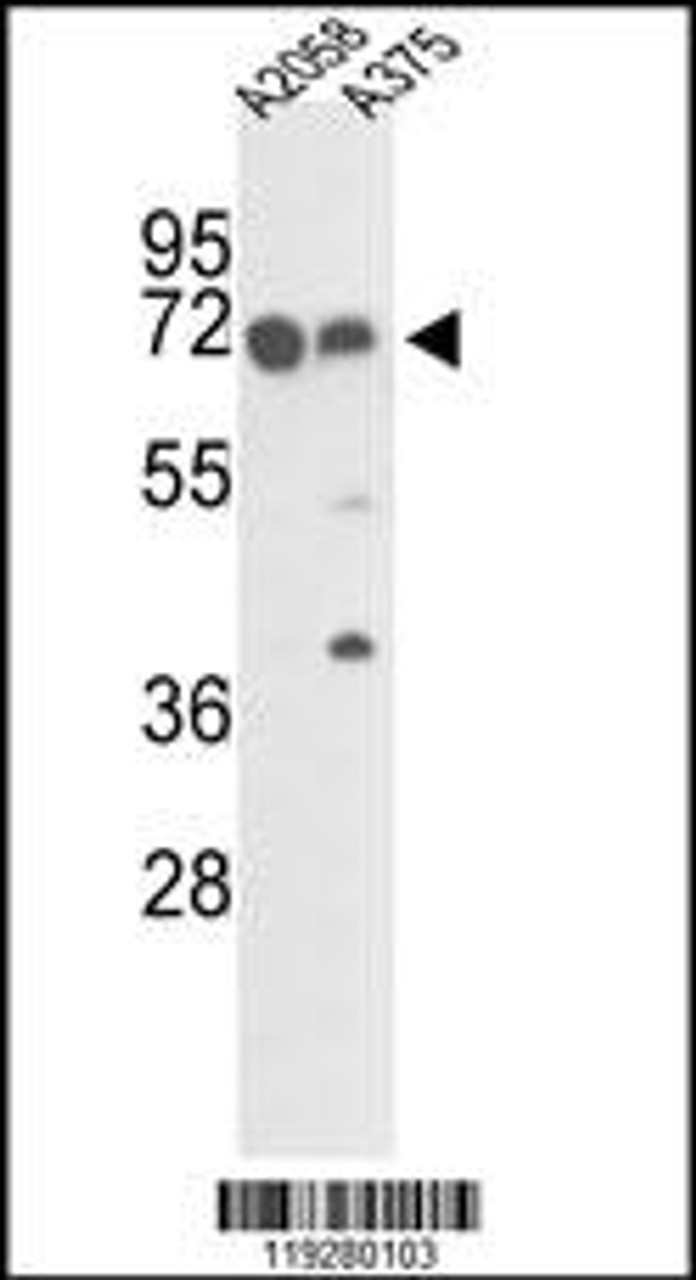 Western blot analysis of FKBP10 Antibody in A2058 and A375 cell line lysates (35ug/lane)