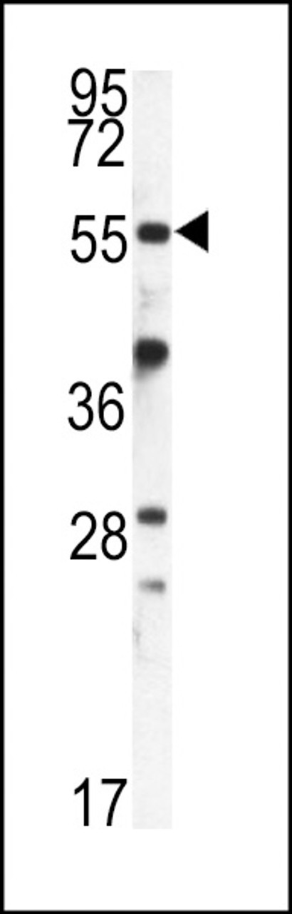 Western blot analysis of FKBP9 antibody in mouse kidney tissue lysates (35ug/lane)