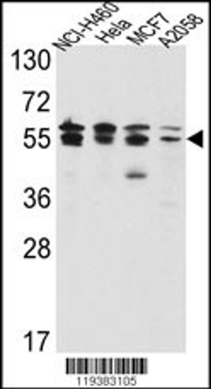 Western blot analysis of IMPDH2 Antibody in NCI-H460, Hela, MCF7, A2058 cell line lysates (35ug/lane)