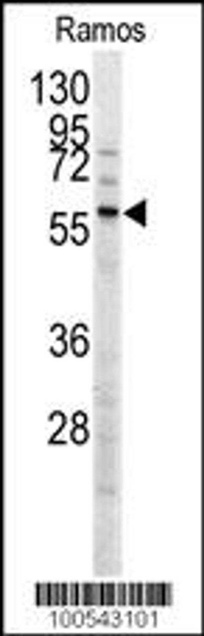 Western blot analysis of anti-MEN1 Antibody (T594) in Ramos cell line lysates (35ug/lane)