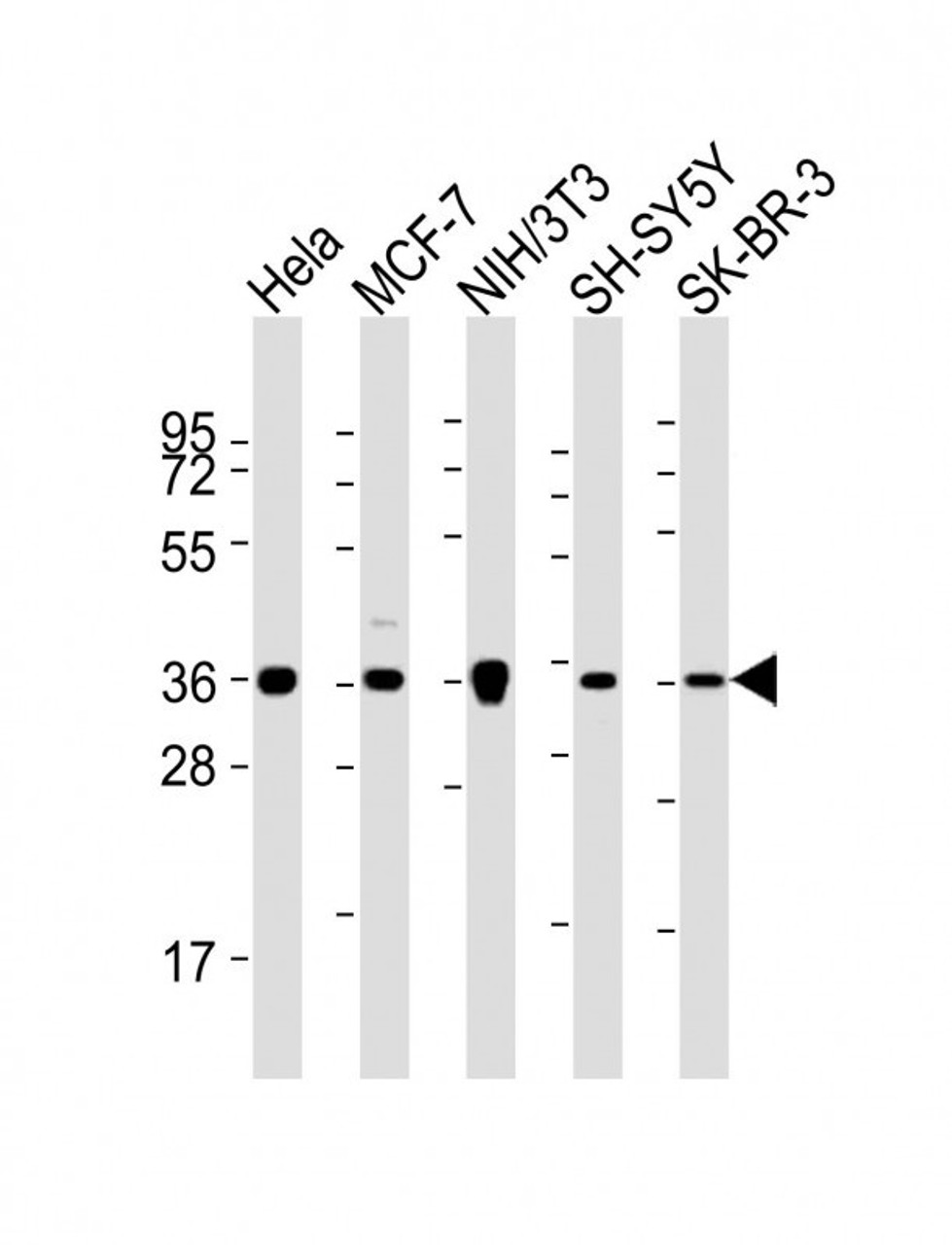 Western Blot at 1:2000 dilution Lane 1: Hela whole cell lysates Lane 2: MCF-7 whole cell lysates Lane 3: NIH/3T3 whole cell lysates Lane 4: SH-SY5Y whole cell lysates Lane 5: SK-BR-3 whole cell lysates Lysates/proteins at 20 ug per lane.