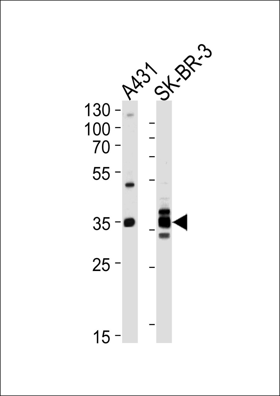 Western blot analysis of lysates from A431, SK-BR-3 cell line (from left to right) , using ANXA2 Antibody at 1:1000 at each lane.