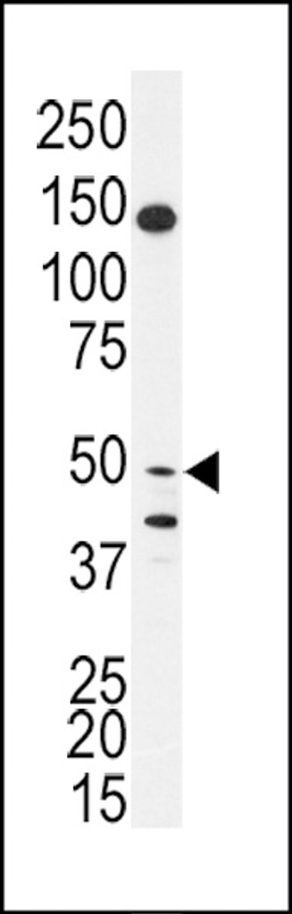 Western blot analysis of anti-BPIL1 Antibody in SK-BR-3 cell line lysates (35ug/lane)