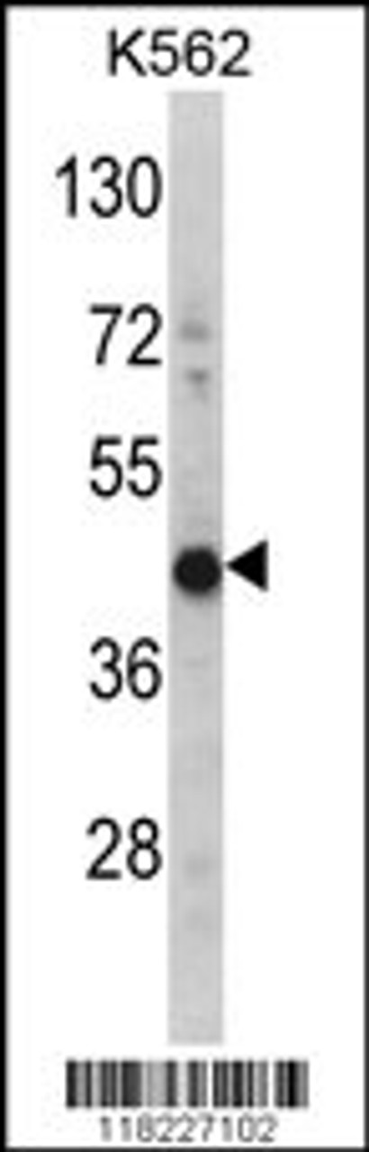 Western blot analysis of HIBCH Antibody in K562 cell line lysates (35ug/lane) (2ug/ml)