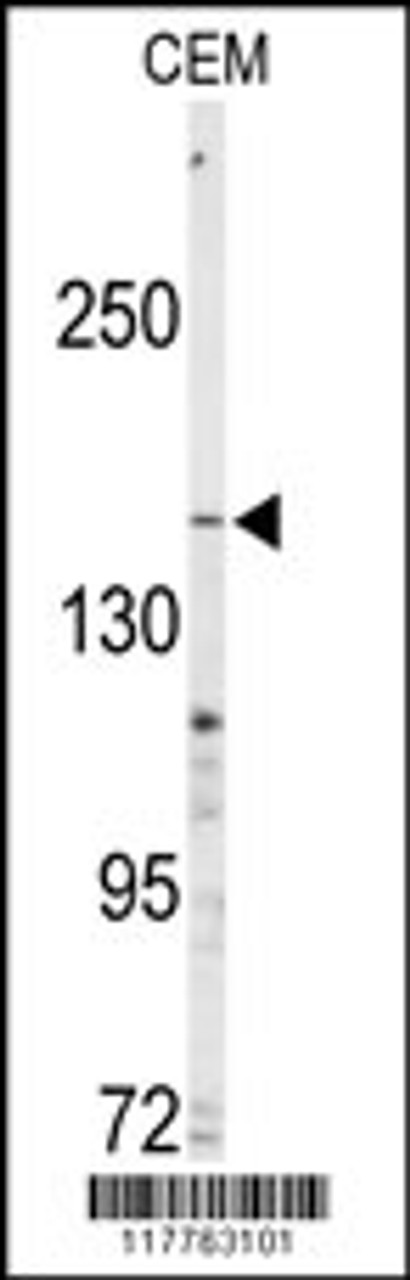 Western blot analysis of anti-ABCC4 Antibody in CEM cell line lysates (35ug/lane)