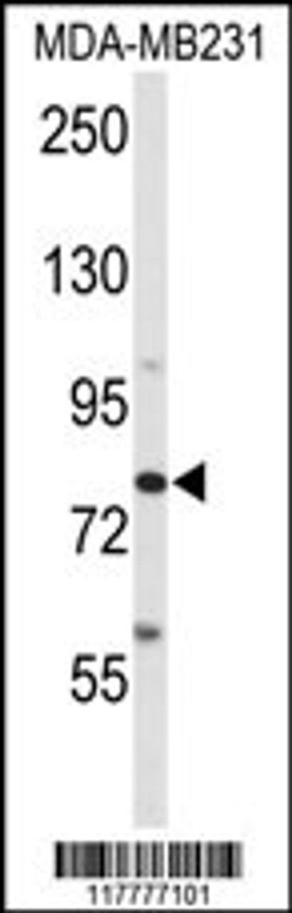 Western blot analysis of ADAM9 Antibody in MDA-MB231 cell line lysates (35ug/lane)
