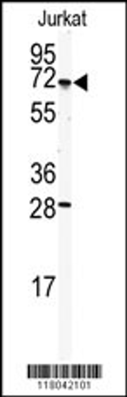 Western blot analysis of anti-CETP Antibody in Jurkat cell line lysates (35ug/lane) .