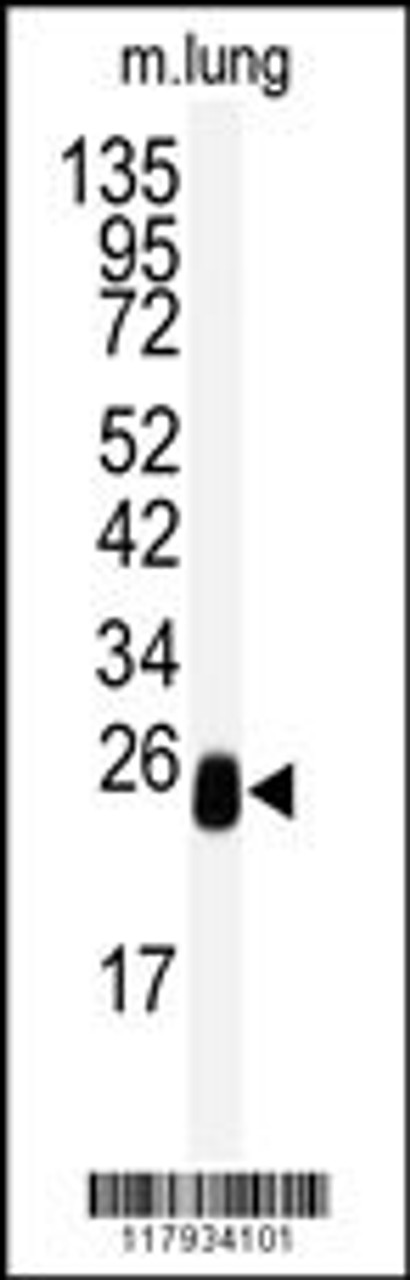 Western blot analysis of anti-DCXR Antibody in mouse lung tissue lysates (35ug/lane)