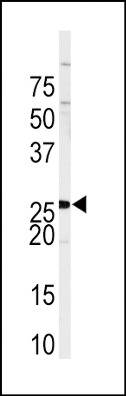 Western blot analysis of anti-SPRY4 Antibody in Sk-Br-3 cell line lysates (35ug/lane)