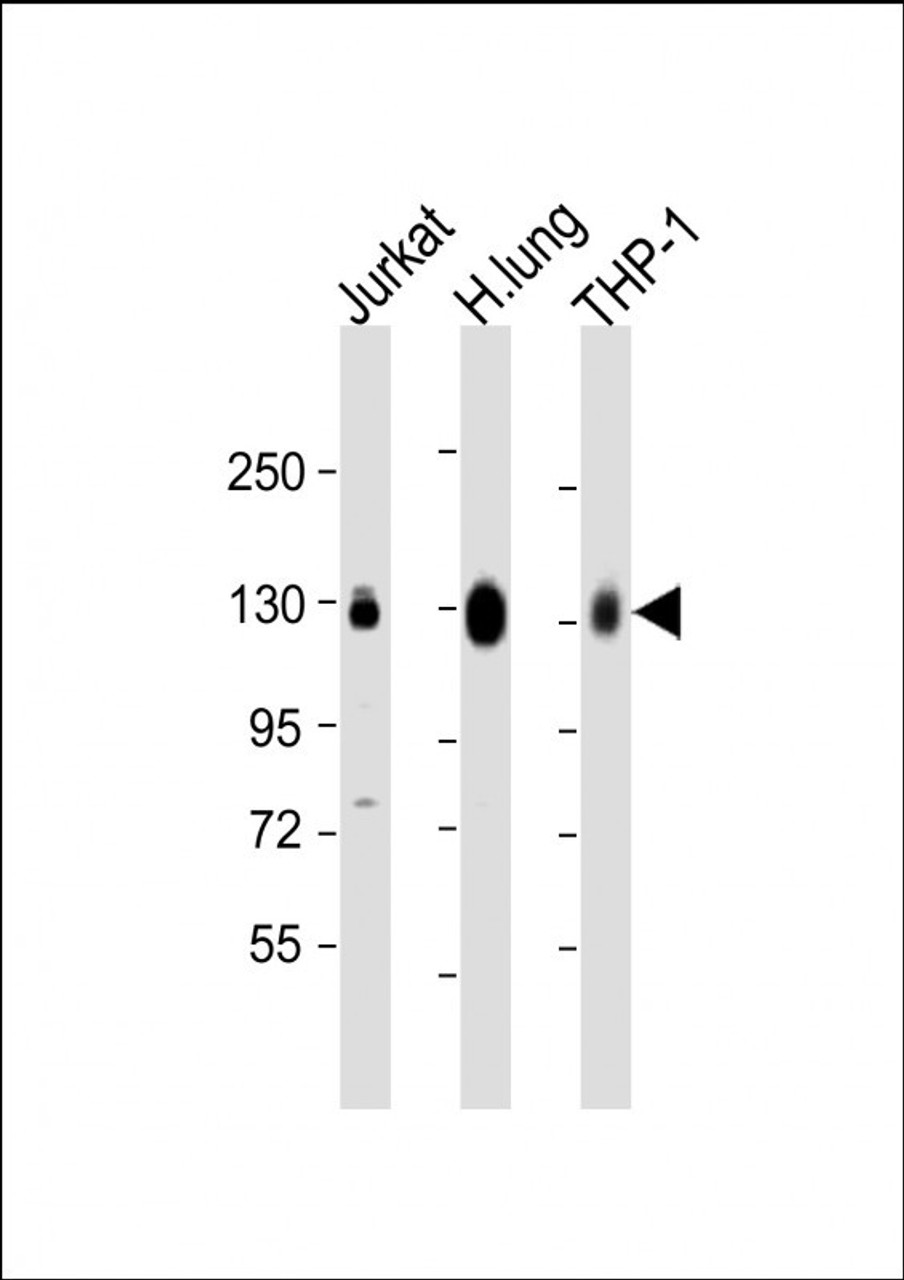 Western Blot at 1:2000 dilution Lane 1: Jurkat whole cell lysate Lane 2: human lung lysate Lane 3: THP-1 whole cell lysate Lysates/proteins at 20 ug per lane.