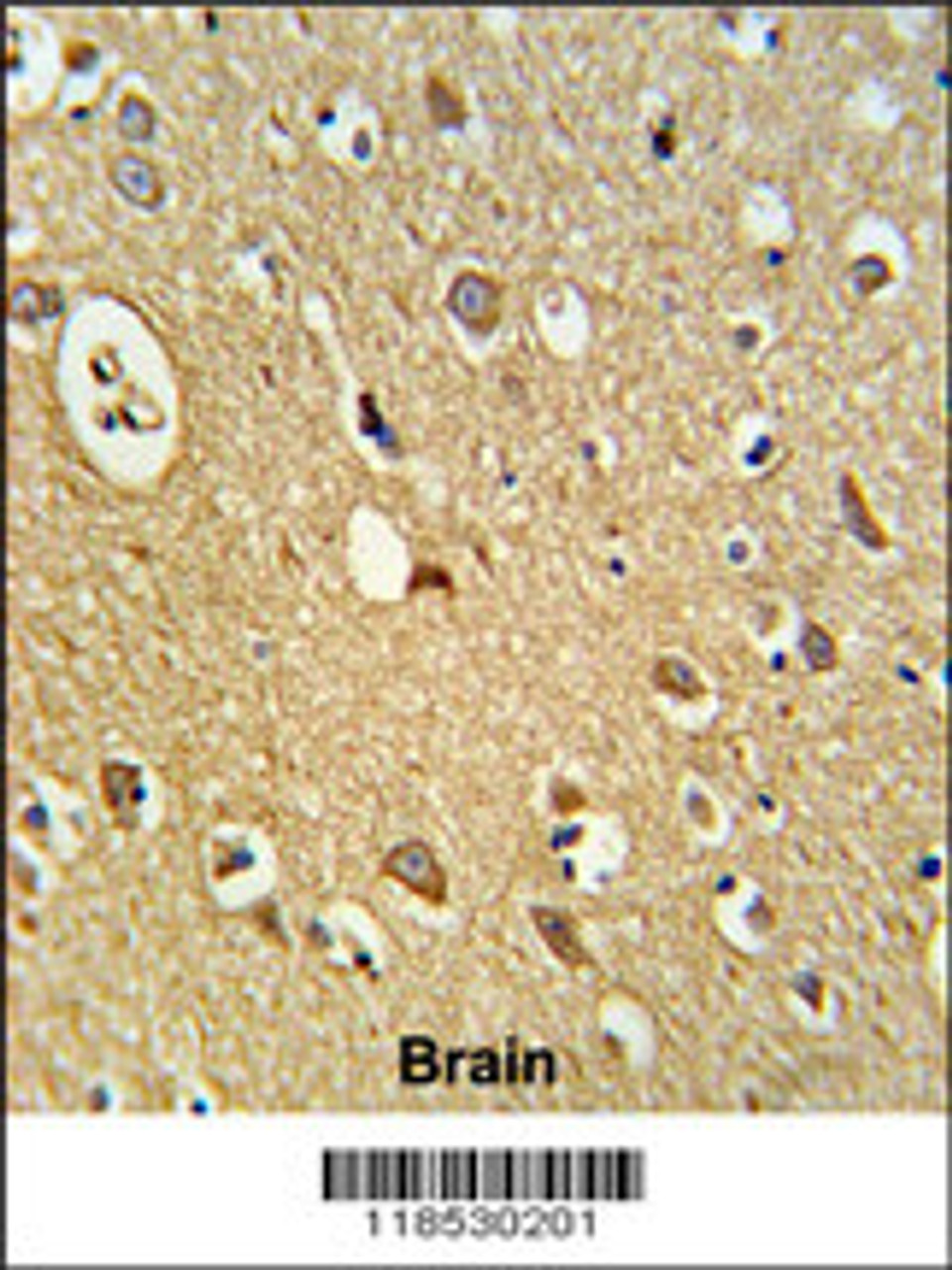 Formalin-fixed and paraffin-embedded human brain tissue reacted with OMD Antibody, which was peroxidase-conjugated to the secondary antibody, followed by DAB staining.