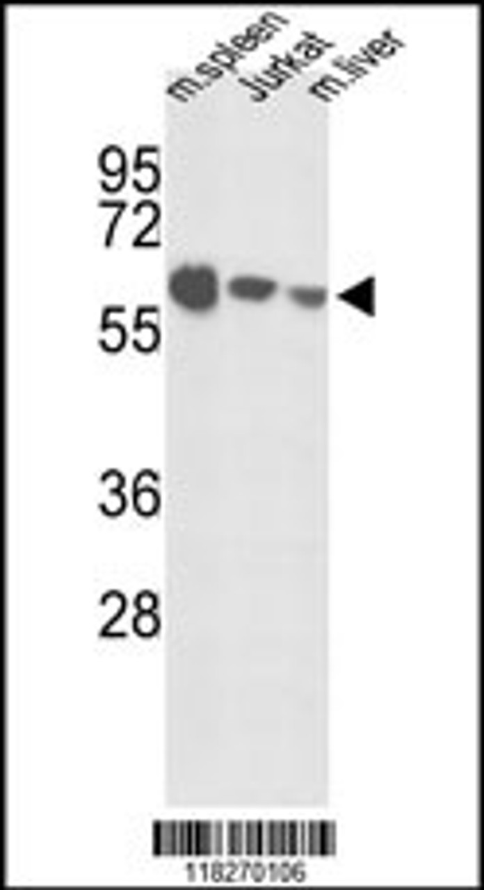 Western blot analysis of IGFALS Antibody in mouse spleen tissue, Jurkat cell line and mouse liver tissue lysates (35ug/lane)