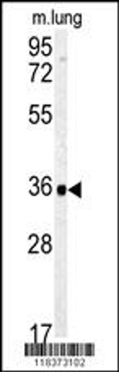 Western blot analysis of CA4 Antibody in mouse lung tissue lysates (35ug/lane)