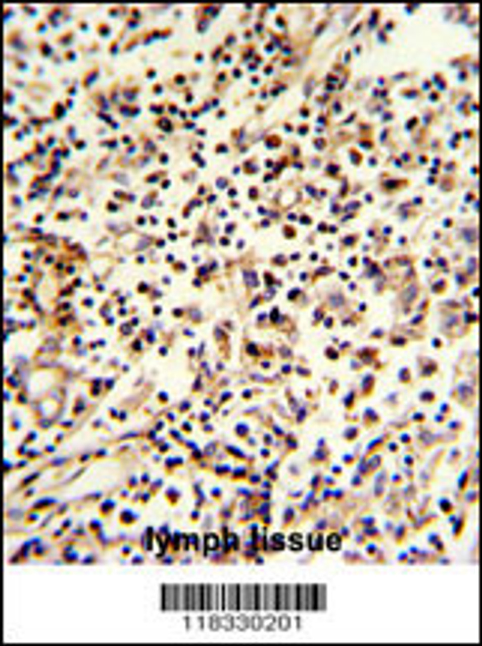 Formalin-fixed and paraffin-embedded human lymph reacted with PCM-1 Antibody, which was peroxidase-conjugated to the secondary antibody, followed by DAB staining.