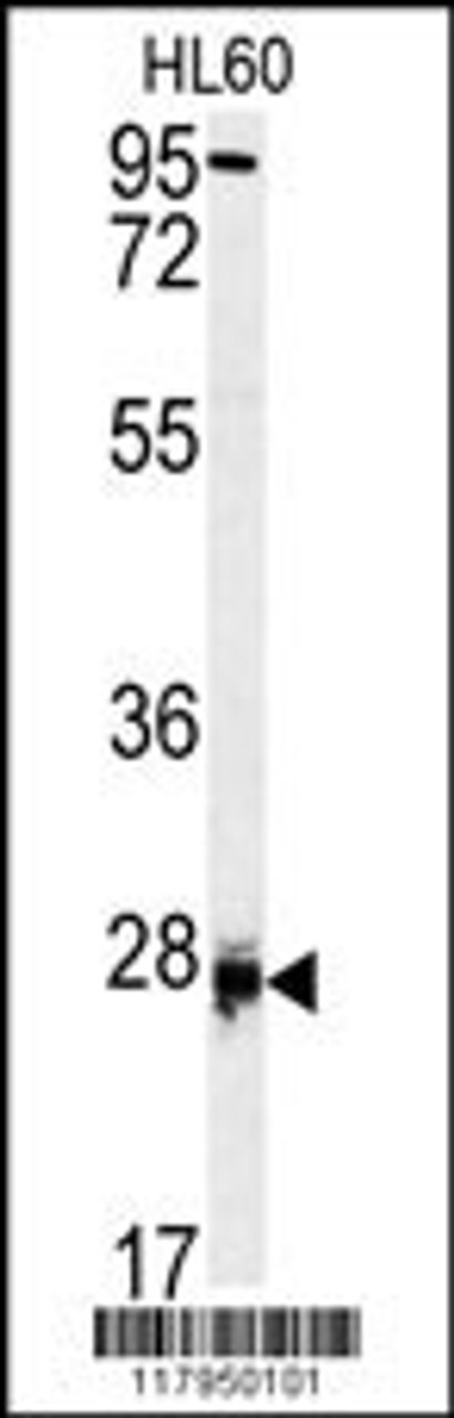 Western blot analysis of DPT antibody in HL60 cell line lysates (35ug/lane)