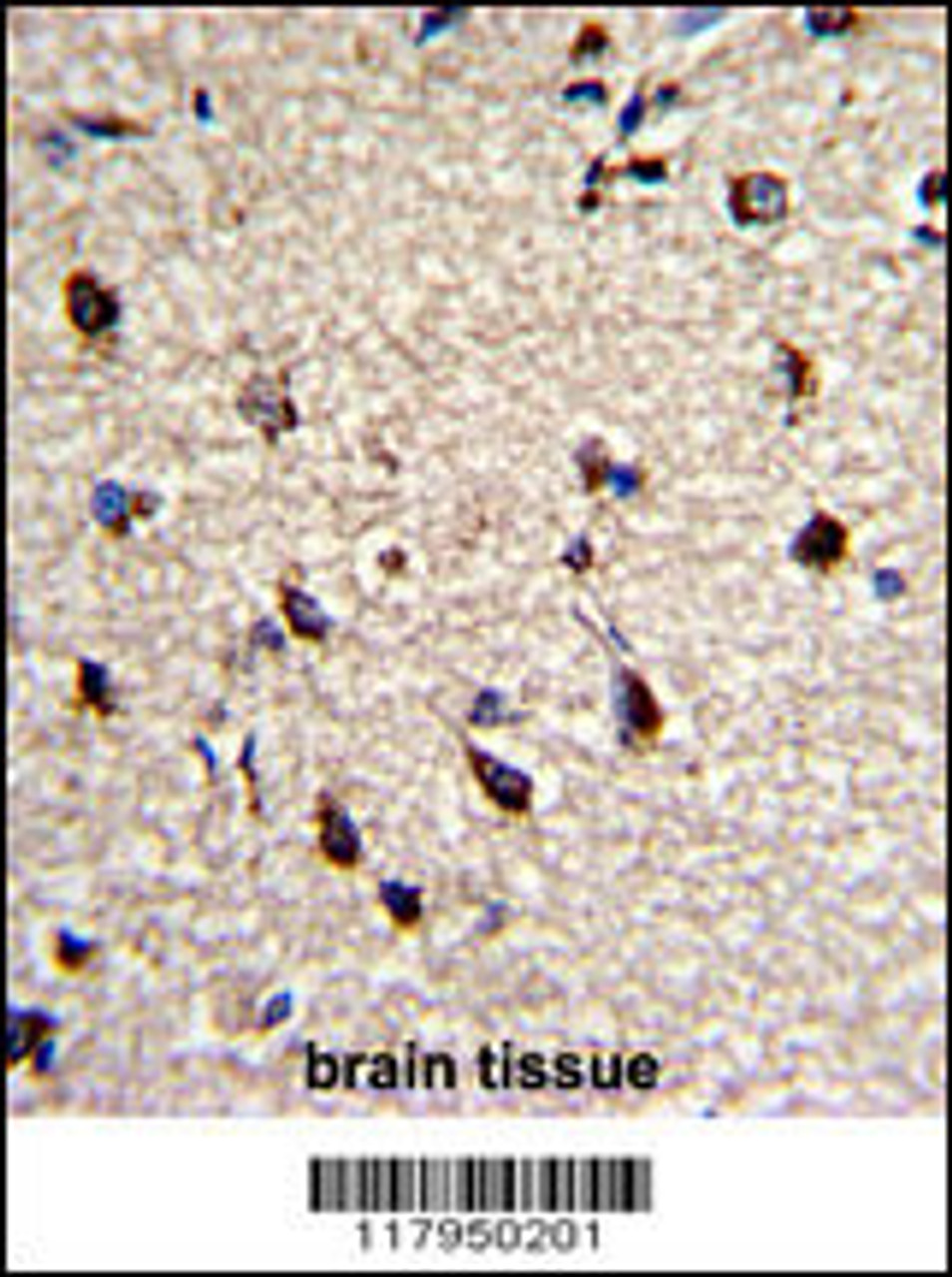 Formalin-fixed and paraffin-embedded human brain with DPT Antibody, which was peroxidase-conjugated to the secondary antibody, followed by DAB staining.