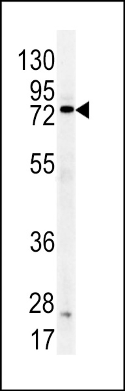 Western blot analysis of DDX53 antibody in mouse kidney tissue lysates (35ug/lane)