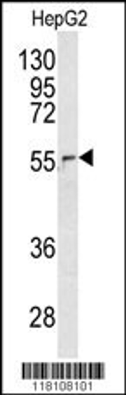 Western blot analysis of in HepG2 cell line lysates (35ug/lane)