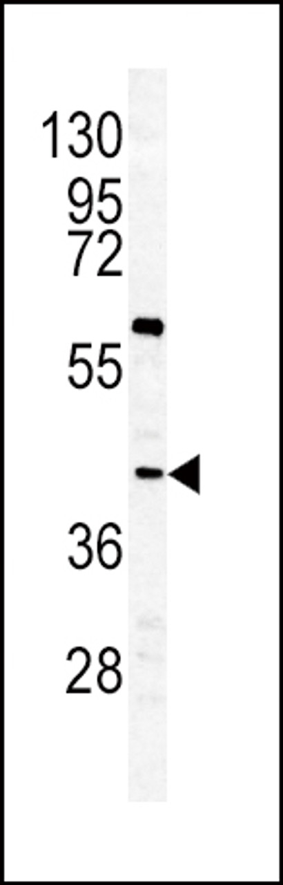 Western blot analysis of GHRHR antibody in K562 cell line lysates (35ug/lane)