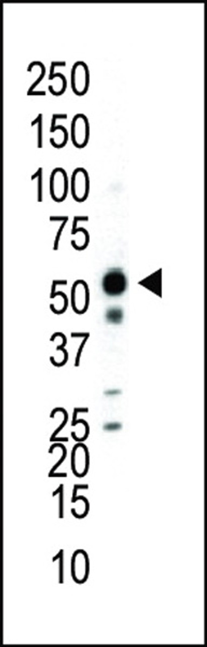 Western blot analysis of anti-JNK2 Pab in Jurkat cell lysate