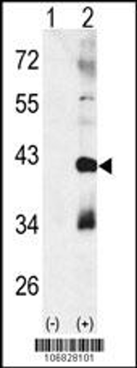 Western blot analysis of CTDSP1 using rabbit polyclonal p38 beta Antibody using 293 cell lysates (2 ug/lane) either nontransfected (Lane 1) or transiently transfected with the CTDSP1 gene (Lane 2) .