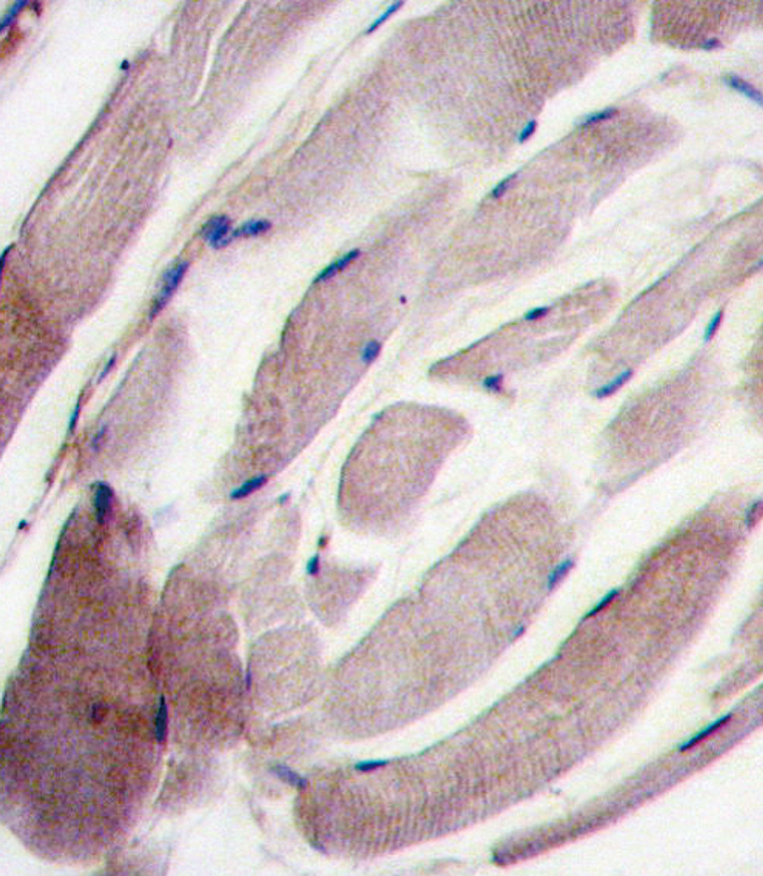 Formalin-fixed and paraffin-embedded human skeletal muscle tissue reacted with the P38 gamma antibody, which was peroxidase-conjugated to the secondary antibody, followed by DAB staining.