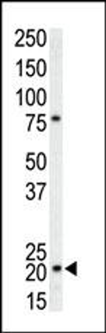 Antibody is used in Western blot to detect CDKN1A in T-47D cell lysate.