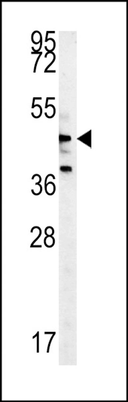 Western blot analysis in Y79 cell line lysates (35ug/lane) .This demonstrates the NLK antibody detected the NLK protein (arrow) .