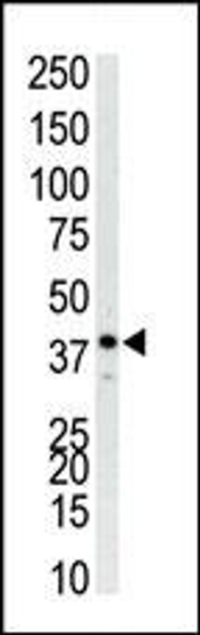 Antibody is used in Western blot to detect P38 in Jurkat cell lysate.