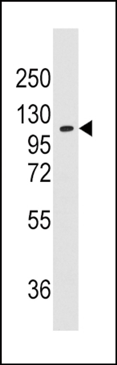 Western blot analysis of anti-AARS Pab in K562 cell line lysates (35ug/lane)