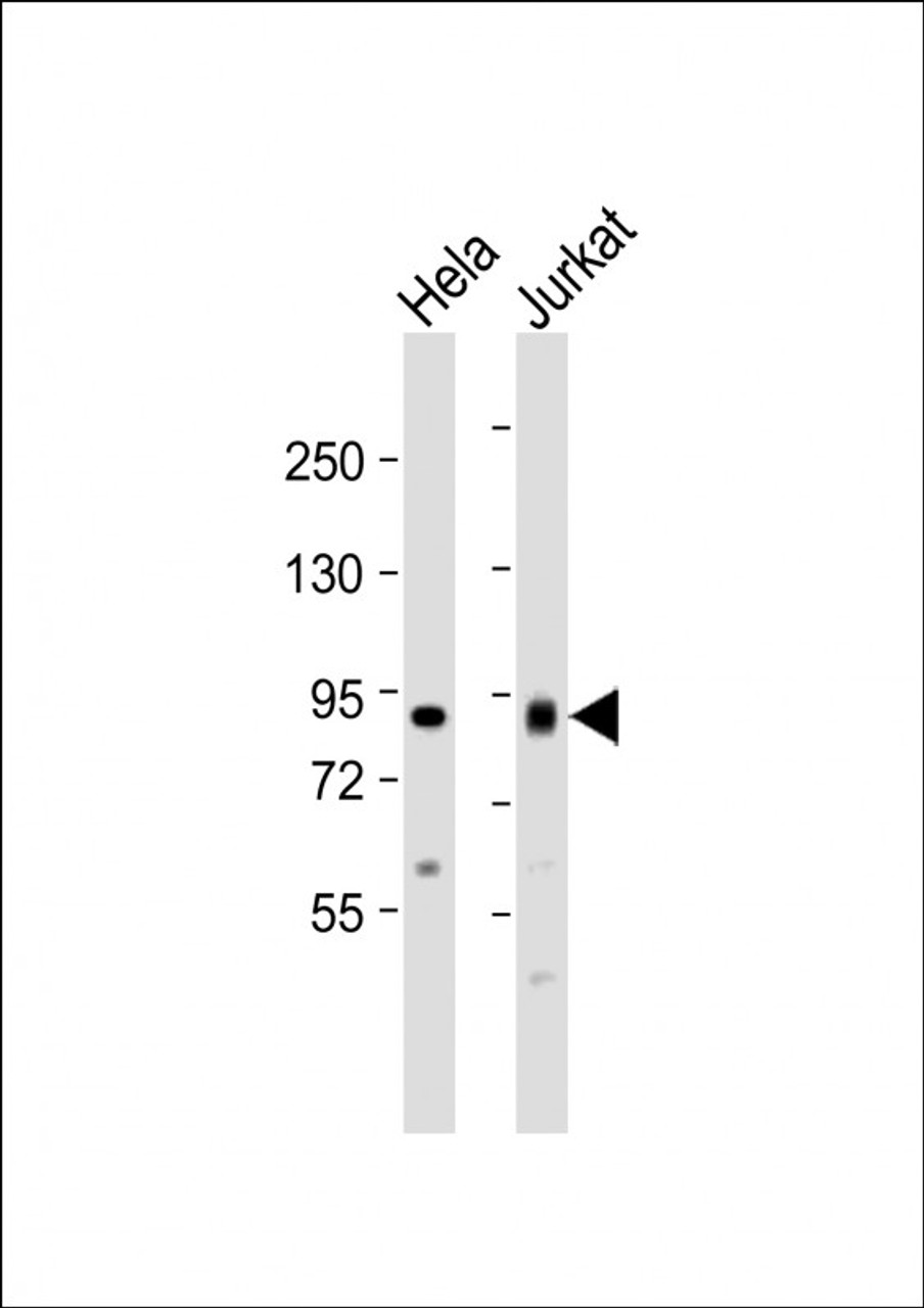 Western Blot at 1:1000 dilution Lane 1: Hela whole cell lysate Lane 2: Jurkat whole cell lysate Lysates/proteins at 20 ug per lane.