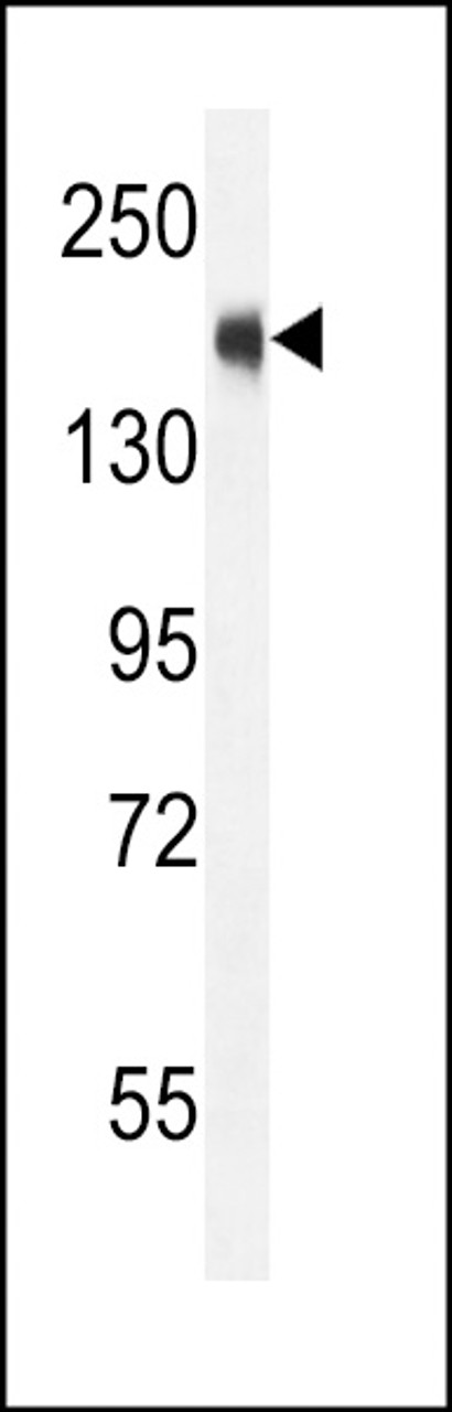 Western blot analysis in CEM cell line lysates (35ug/lane) .