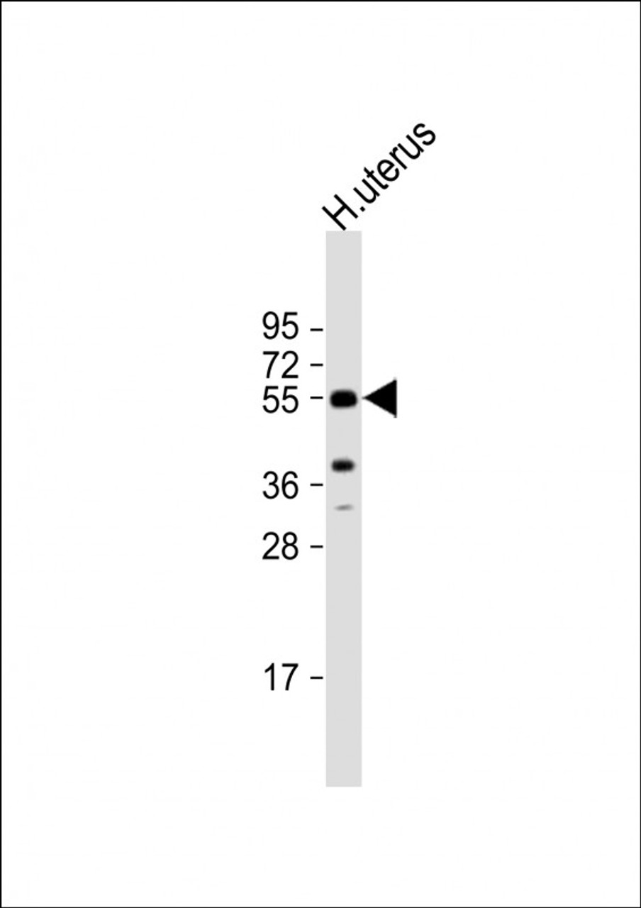 Western Blot at 1:1000 dilution + human uterus lysate Lysates/proteins at 20 ug per lane.