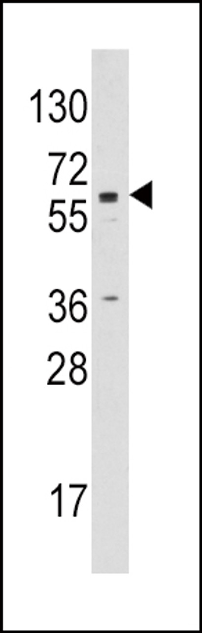 Western blot analysis of anti-CYP19A1 Pab in Jurkat cell line lysates (35ug/lane)