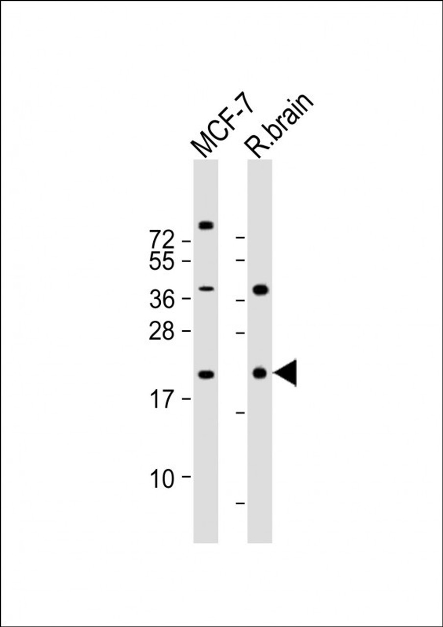 Western Blot at 1:2000 dilution Lane 1: MCF-7 whole cell lysate Lane 2: rat brain lysate Lysates/proteins at 20 ug per lane.